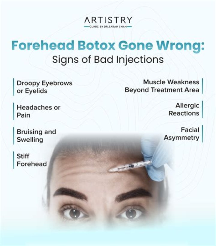 Unveiling The Hidden Dangers: Botox Gone Wrong